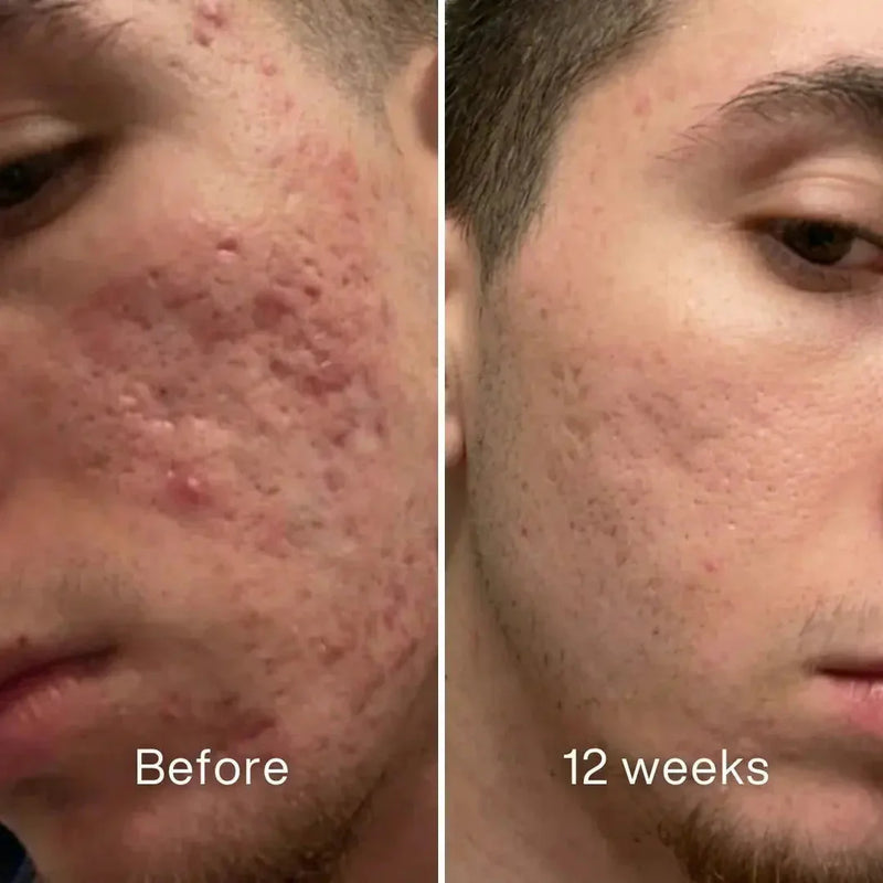 Prima e dopo