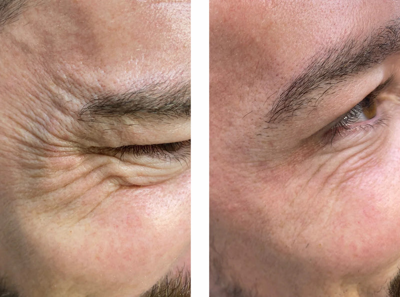 Before and after