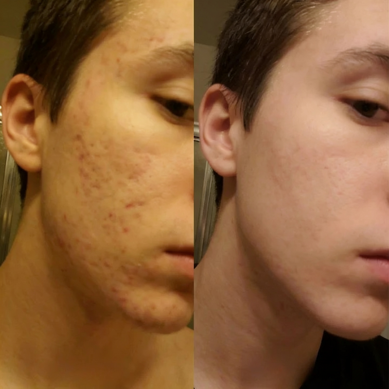 Prima e dopo